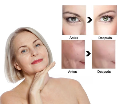 Masajeador facial con frío y calor antiarrugas rosa