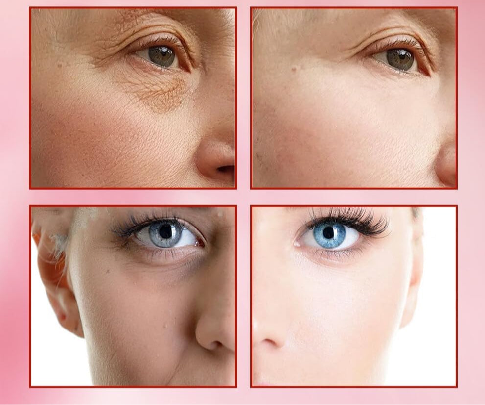 Masajeador facial con frío y calor antiarrugas rosa